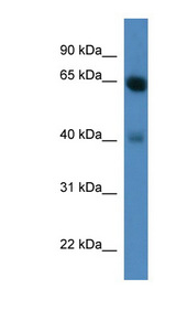 NTRK2 / TRKB Antibody - NTRK2 / TRKB antibody Western blot of Fetal Heart lysate. This image was taken for the unconjugated form of this product. Other forms have not been tested.