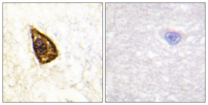 NTRK2 / TRKB Antibody - Immunohistochemistry analysis of paraffin-embedded human brain tissue, using Trk B Antibody. The picture on the right is blocked with the synthesized peptide.