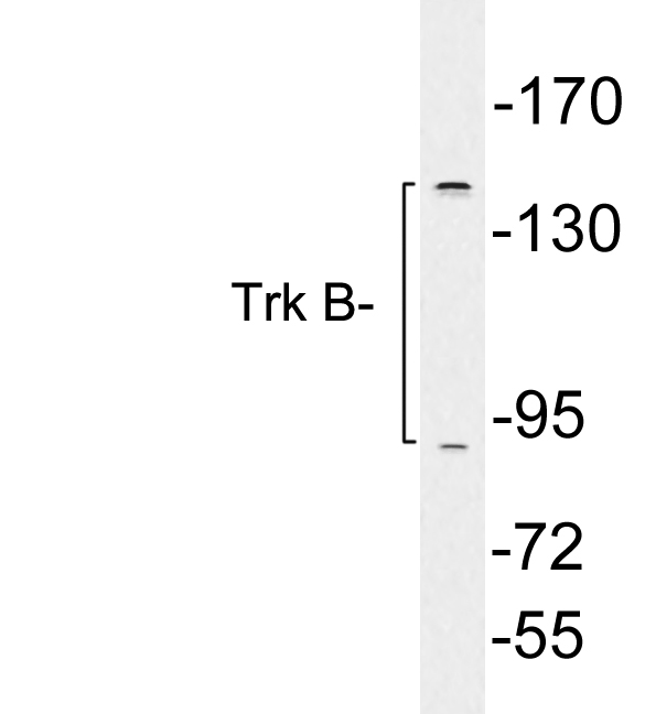 NTRK2 / TRKB Antibody - Western blot analysis of lysates from K562 cells, using Trk B antibody.