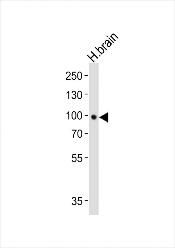 NTRK2 / TRKB Antibody - Western blot of lysate from human brain tissue lysate, using NTRK2 antibody diluted at 1:1000. A goat anti-rabbit IgG H&L (HRP) at 1:10000 dilution was used as the secondary antibody. Lysate at 20 ug.