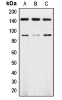 NTRK2 / TRKB Antibody - Western blot analysis of TRK B expression in HL60 (A); SKNSH (B); mouse brain (C) whole cell lysates.