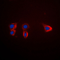NTRK2 / TRKB Antibody - Immunofluorescent analysis of TRK B staining in HL60 cells. Formalin-fixed cells were permeabilized with 0.1% Triton X-100 in TBS for 5-10 minutes and blocked with 3% BSA-PBS for 30 minutes at room temperature. Cells were probed with the primary antibody in 3% BSA-PBS and incubated overnight at 4 C in a humidified chamber. Cells were washed with PBST and incubated with a DyLight 594-conjugated secondary antibody (red) in PBS at room temperature in the dark. DAPI was used to stain the cell nuclei (blue).