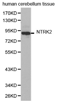 NTRK2 / TRKB Antibody - Western blot analysis of extracts of human cerebellum tissue.