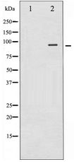 NTRK2 / TRKB Antibody - Western blot of Trk B expression in NIH-3T3 whole cell lysates,The lane on the left is treated with the antigen-specific peptide.
