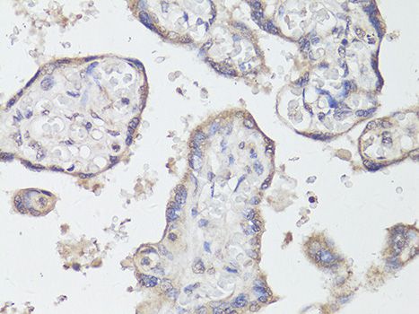 NTRK2 / TRKB Antibody - Immunohistochemistry of paraffin-embedded human placenta using NTRK2 antibody at dilution of 1:200 (40x lens).