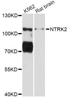 NTRK2 / TRKB Antibody - Western blot analysis of extracts of various cell lines, using NTRK2 Antibody at 1:3000 dilution. The secondary antibody used was an HRP Goat Anti-Rabbit IgG (H+L) at 1:10000 dilution. Lysates were loaded 25ug per lane and 3% nonfat dry milk in TBST was used for blocking. An ECL Kit was used for detection and the exposure time was 30s.