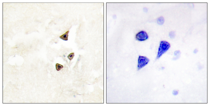NTRK2 / TRKB Antibody - Immunohistochemistry analysis of paraffin-embedded human brain, using Trk B (Phospho-Tyr515) Antibody. The picture on the right is blocked with the phospho peptide.