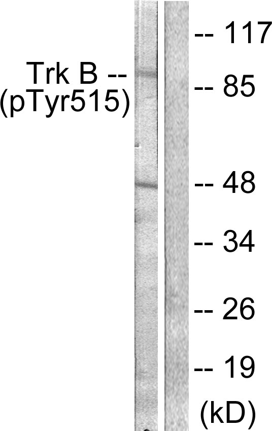 NTRK2 / TRKB Antibody - Western blot analysis of lysates from NIH/3T3 cells, using Trk B (Phospho-Tyr515) Antibody. The lane on the right is blocked with the phospho peptide.