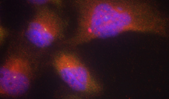 NTRK2 / TRKB Antibody - Immunofluorescence staining of methanol-fixed Hela cells.