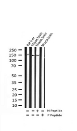 NTRK2 / TRKB Antibody - Western blot analysis of Phospho-Trk B (Tyr515) expression in various lysates