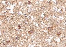 NTRK2 / TRKB Antibody - 1:100 staining human brain tissue by IHC-P. The tissue was formaldehyde fixed and a heat mediated antigen retrieval step in citrate buffer was performed. The tissue was then blocked and incubated with the antibody for 1.5 hours at 22°C. An HRP conjugated goat anti-rabbit antibody was used as the secondary.