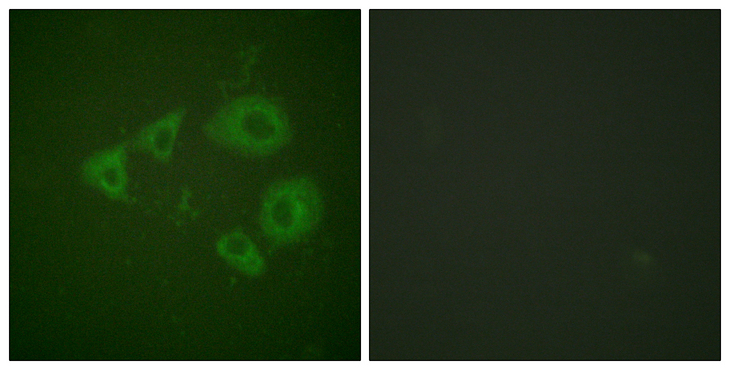 NTRK2 / TRKB Antibody - Immunofluorescence analysis of HUVEC cells, using Trk B (Phospho-Tyr705) Antibody. The picture on the right is blocked with the phospho peptide.