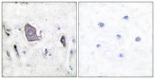 NTRK2 / TRKB Antibody - Immunohistochemistry analysis of paraffin-embedded human brain, using Trk B (Phospho-Tyr705) Antibody. The picture on the right is blocked with the phospho peptide.