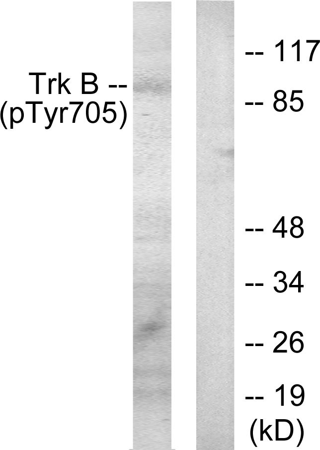 NTRK2 / TRKB Antibody - Western blot analysis of lysates from mouse kidney, using Trk B (Phospho-Tyr705) Antibody. The lane on the right is blocked with the phospho peptide.