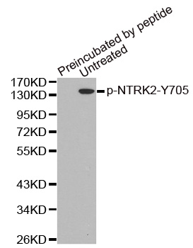 NTRK2 / TRKB Antibody - Western blot analysis of extracts from mouse brain tissue.
