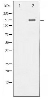 NTRK2 / TRKB Antibody - Western blot of Trk B phosphorylation expression in Mouse kidney tissue lysates,The lane on the left is treated with the antigen-specific peptide.