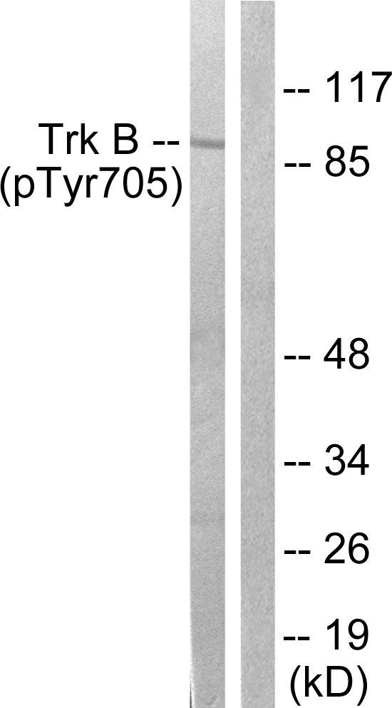 NTRK2 / TRKB Antibody - Western blot analysis of extracts from mouse kidney, using Trk B (phospho-Tyr705) antibody.