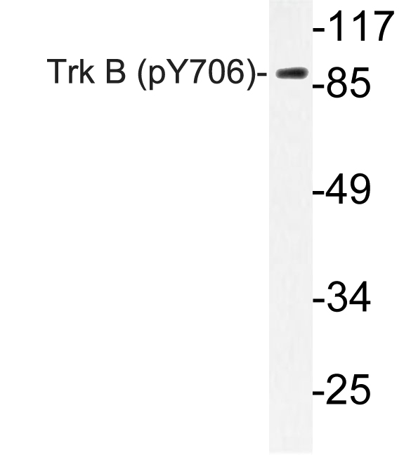 NTRK2 / TRKB Antibody - Western blot of p-Trk B (Y706) pAb in extracts from mouse kidney cells.