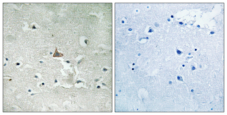 NTRK2 / TRKB Antibody - Immunohistochemistry analysis of paraffin-embedded human brain, using Trk B (Phospho-Tyr706+Tyr707) Antibody. The picture on the right is blocked with the phospho peptide.