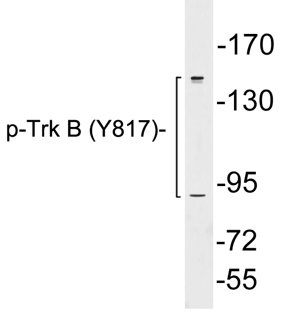 NTRK2 / TRKB Antibody - Western blot analysis of lysates from K562 cells, using p-Thrrk B (Phospho-Tyr817) antibody.