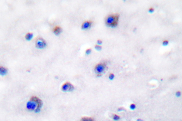 NTRK2 / TRKB Antibody - IHC of Trk B (V509) pAb in paraffin-embedded human brain tissue.