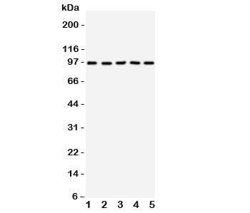 NTRK3 / TRKC Antibody - Western blot testing of TRKC antibody on Lane 1: rat brain; 2: mouse brain; 3: human U87; 4: (h) SHG-44; 5: (m) Neuro-2a cell lysate. Observed molecular weight 95~145 kDa depending on glycosylation level.