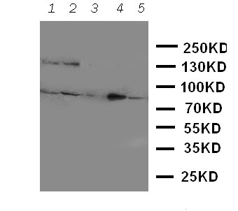 NTRK3 / TRKC Antibody - WB of NTRK3 / TRKC antibody. Lane 1: Rat Brain Tissue Lysate. Lane 2: Mouse Brain Tissue Lysate. Lane 3: U87 Cell Lysate. Lane 4: SHG Cell Lysate. Lane 5: NEURO Cell Lysate.