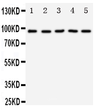 NTRK3 / TRKC Antibody - Anti-TrkC antibody, Western blotting Lane 1: Rat Brain Tissue LysateLane 2: Mouse Brain Tissue LysateLane 3: U87 Cell LysateLane 4: SHG Cell LysateLane 5: NEURO Cell Lysate