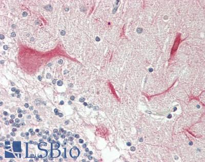 NTRK3 / TRKC Antibody - Human Brain, Cerebellum: Formalin-Fixed, Paraffin-Embedded (FFPE).  This image was taken for the unconjugated form of this product. Other forms have not been tested.