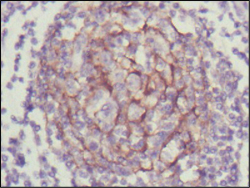 NTRK3 / TRKC Antibody - IHC of paraffin-embedded human lymph node using NTRK3 mouse monoclonal antibody with DAB staining.