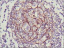 NTRK3 / TRKC Antibody - IHC of paraffin-embedded human lymph node using NTRK3 mouse monoclonal antibody with DAB staining.