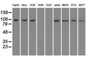NTRK3 / TRKC Antibody - Western blot of extracts (35 ug) from 9 different cell lines by using anti-NTRK3 monoclonal antibody.