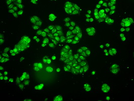 NTRK3 / TRKC Antibody - Immunofluorescent staining of HT29 cells using anti-NTRK3 mouse monoclonal antibody.