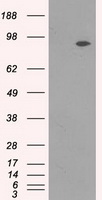 NTRK3 / TRKC Antibody - HEK293T cells were transfected with the pCMV6-ENTRY control (Left lane) or pCMV6-ENTRY NTRK3 (Right lane) cDNA for 48 hrs and lysed. Equivalent amounts of cell lysates (5 ug per lane) were separated by SDS-PAGE and immunoblotted with anti-NTRK3.