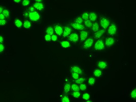 NTRK3 / TRKC Antibody - Immunofluorescent staining of HT29 cells using anti-NTRK3 mouse monoclonal antibody.