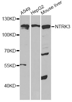 NTRK3 / TRKC Antibody - Western blot analysis of extracts of various cell lines, using NTRK3 antibody at 1:1000 dilution. The secondary antibody used was an HRP Goat Anti-Rabbit IgG (H+L) at 1:10000 dilution. Lysates were loaded 25ug per lane and 3% nonfat dry milk in TBST was used for blocking. An ECL Kit was used for detection and the exposure time was 90s.