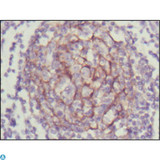 NTRK3 / TRKC Antibody - Immunohistochemistry (IHC) analysis of paraffin-embedded Human Lymph node with DAB staining using Trk C Monoclonal Antibody.