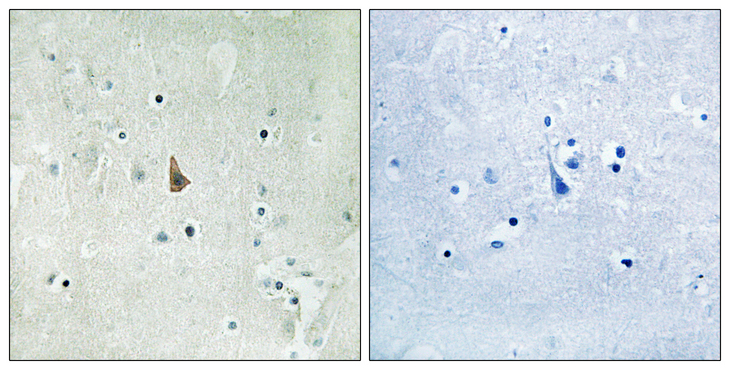 NTRK3 / TRKC Antibody - Immunohistochemistry analysis of paraffin-embedded human brain, using Trk C (Phospho-Tyr516) Antibody. The picture on the right is blocked with the phospho peptide.
