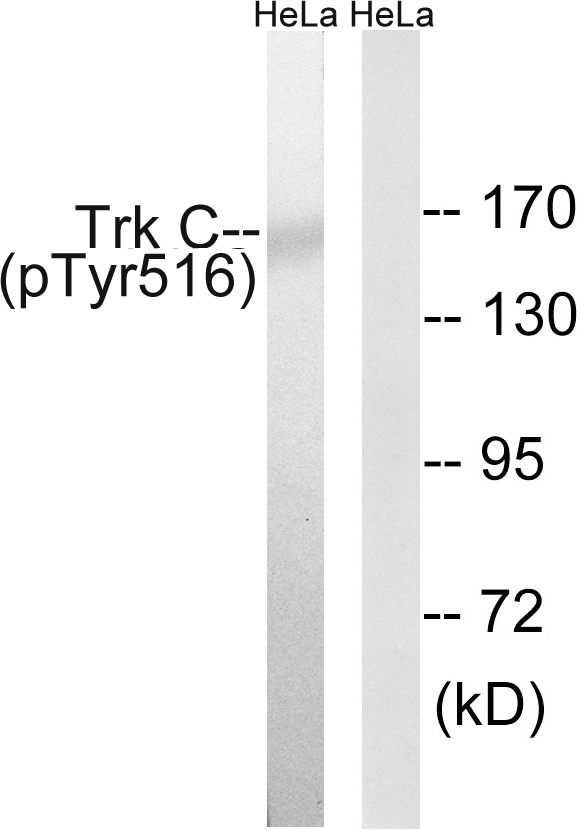 NTRK3 / TRKC Antibody - Western blot analysis of lysates from HeLa cells treated with serum 20% 15', using Trk C (Phospho-Tyr516) Antibody. The lane on the right is blocked with the phospho peptide.