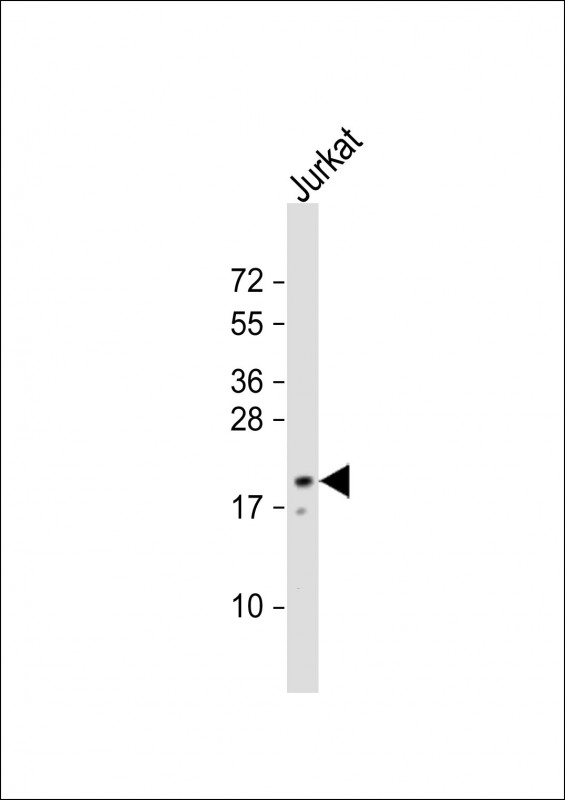 NTS / NT / Neurotensin Antibody - Anti-NTS Antibody (Center) at 1:500 dilution + Jurkat whole cell lysate Lysates/proteins at 20 ug per lane. Secondary Goat Anti-Rabbit IgG, (H+L), Peroxidase conjugated at 1:10000 dilution. Predicted band size: 20 kDa. Blocking/Dilution buffer: 5% NFDM/TBST.
