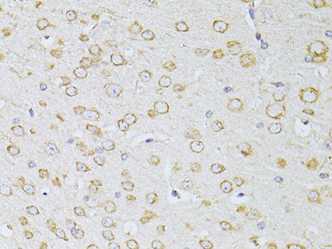 NTS / NT / Neurotensin Antibody - Immunohistochemistry of paraffin-embedded mouse brain using NTS antibody at dilution of 1:100 (40x lens).