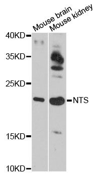 NTS / NT / Neurotensin Antibody - Western blot analysis of extracts of various cell lines, using NTS antibody at 1:3000 dilution. The secondary antibody used was an HRP Goat Anti-Rabbit IgG (H+L) at 1:10000 dilution. Lysates were loaded 25ug per lane and 3% nonfat dry milk in TBST was used for blocking. An ECL Kit was used for detection and the exposure time was 90s.