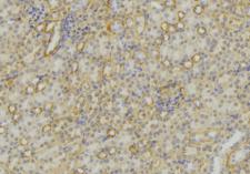 NTS / NT / Neurotensin Antibody - 1:100 staining mouse kidney tissue by IHC-P. The sample was formaldehyde fixed and a heat mediated antigen retrieval step in citrate buffer was performed. The sample was then blocked and incubated with the antibody for 1.5 hours at 22°C. An HRP conjugated goat anti-rabbit antibody was used as the secondary.