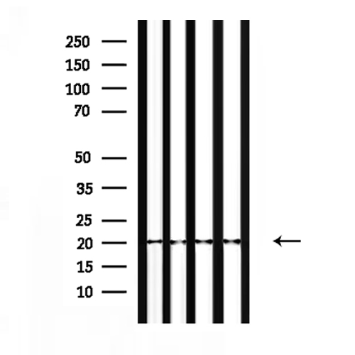 NTS / NT / Neurotensin Antibody - Western blot analysis of extracts of mouse lung, mouse brain, rat brain, mouse liver tissue using NTS antibody.