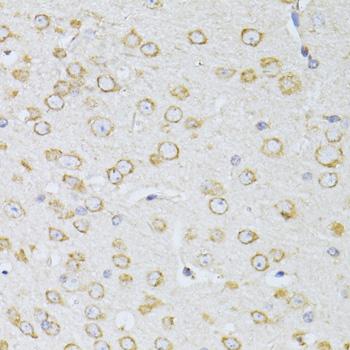 NTS / NT / Neurotensin Antibody - Immunohistochemistry of paraffin-embedded Mouse brain using NTS Polyclonal Antibody at dilution of 1:100 (40x lens).