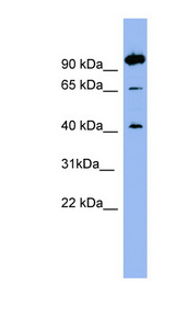 NTSR1 / NTR Antibody - NTSR1 antibody Western blot of OVCAR-3 cell lysate. This image was taken for the unconjugated form of this product. Other forms have not been tested.