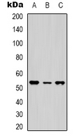 NTSR1 / NTR Antibody - Western blot analysis of NTR1 expression in HeLa (A); MCF7 (B); Jurkat (C) whole cell lysates.