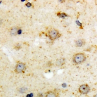 NTSR1 / NTR Antibody - Immunohistochemical analysis of NTR1 staining in human brain formalin fixed paraffin embedded tissue section. The section was pre-treated using heat mediated antigen retrieval with sodium citrate buffer (pH 6.0). The section was then incubated with the antibody at room temperature and detected using an HRP polymer system. DAB was used as the chromogen. The section was then counterstained with hematoxylin and mounted with DPX.