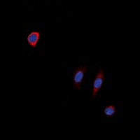 NTSR1 / NTR Antibody - Immunofluorescent analysis of NTR1 staining in SKNSH cells. Formalin-fixed cells were permeabilized with 0.1% Triton X-100 in TBS for 5-10 minutes and blocked with 3% BSA-PBS for 30 minutes at room temperature. Cells were probed with the primary antibody in 3% BSA-PBS and incubated overnight at 4 deg C in a humidified chamber. Cells were washed with PBST and incubated with a DyLight 594-conjugated secondary antibody (red) in PBS at room temperature in the dark. DAPI was used to stain the cell nuclei (blue).
