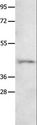 NTSR1 / NTR Antibody - Western blot analysis of 231 cell, using NTSR1 Polyclonal Antibody at dilution of 1:800.